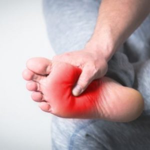 Fascitis Plantar